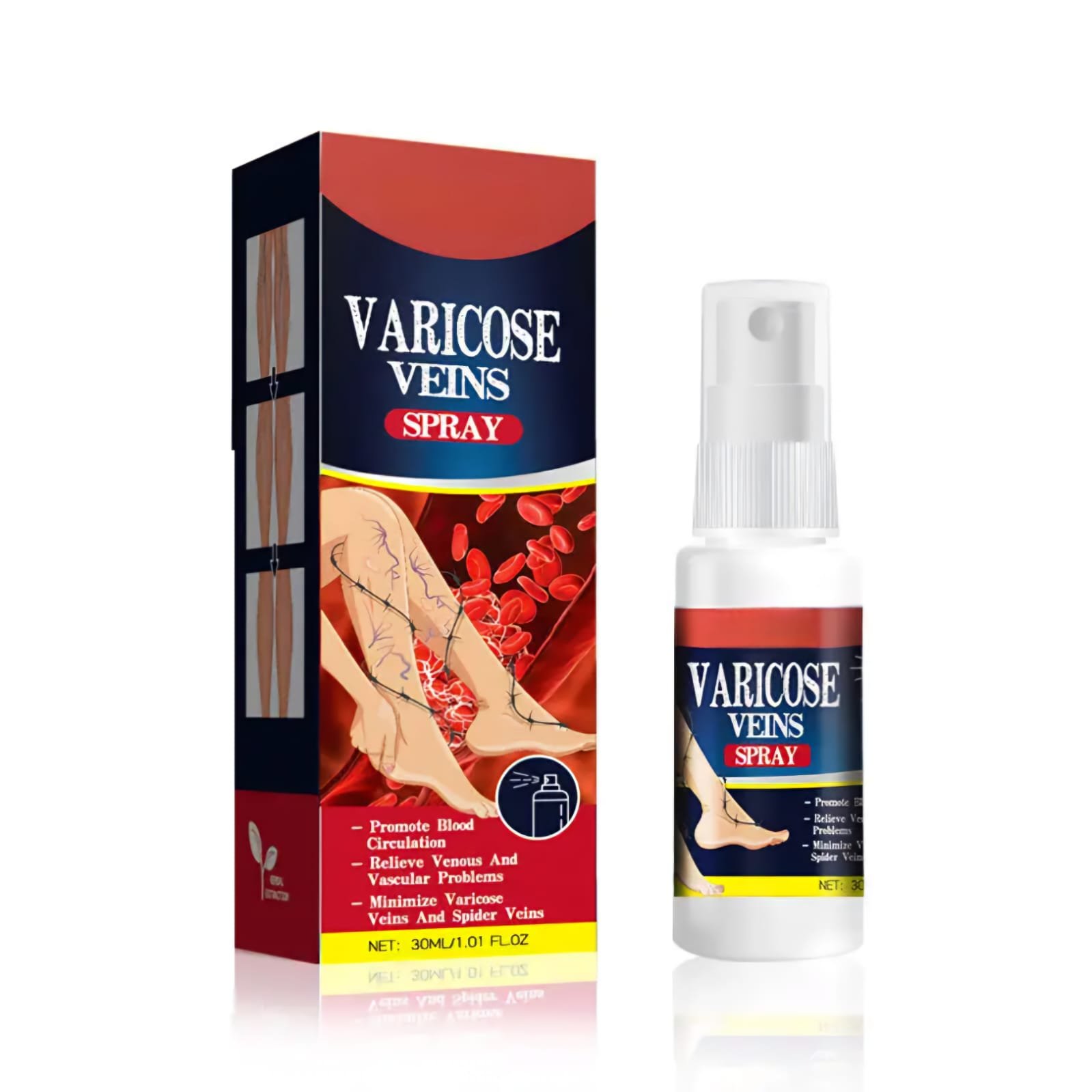 Varicose veins 5
